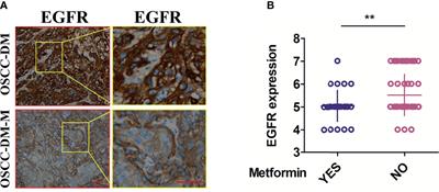 Metformin Downregulates the Expression of Epidermal Growth Factor Receptor Independent of Lowering Blood Glucose in Oral Squamous Cell Carcinoma